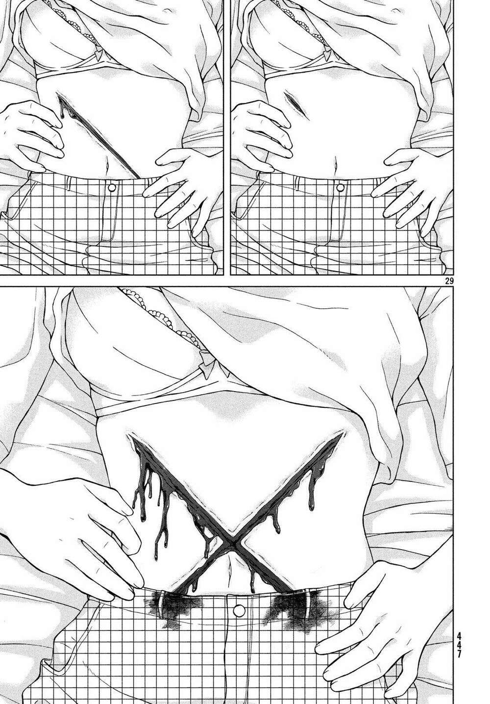 Aono-Kun Ni Sawaritai Kara Shinitai Chương 20 Ảnh 32