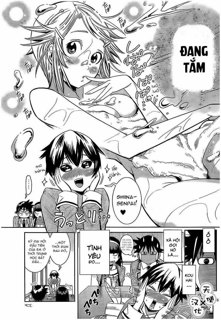 Nozo X Kimi Chương 22 Ảnh 17
