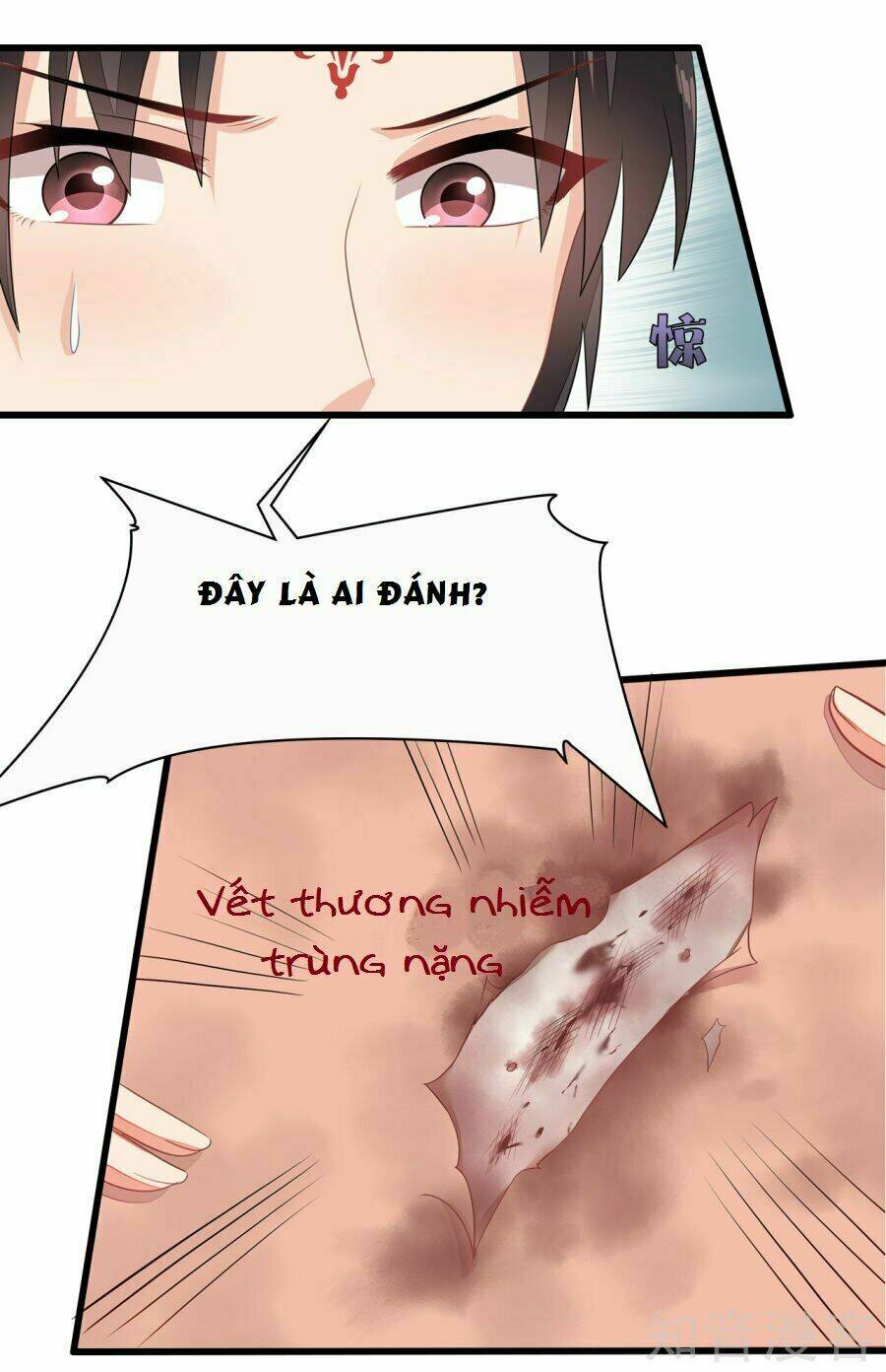 Tà Vương Thần Phi: Y Thủ Che Thiên Chương 8 Ảnh 19